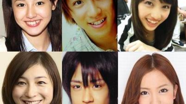 Inilah peringkat selebriti Jepang dengan gigi yaeba (gingsul) terbaik pilihan penggemar Inilah peringkat selebriti Jepang dengan gigi yaeba (gingsul) terbaik pilihan penggemar
