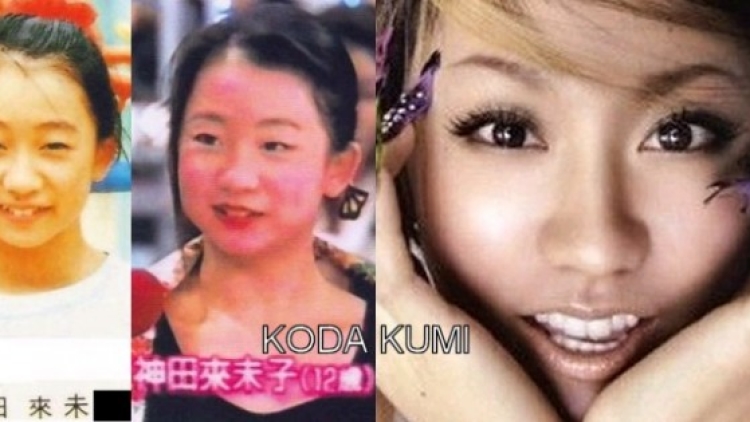 Operasi Plastik Di Jepang