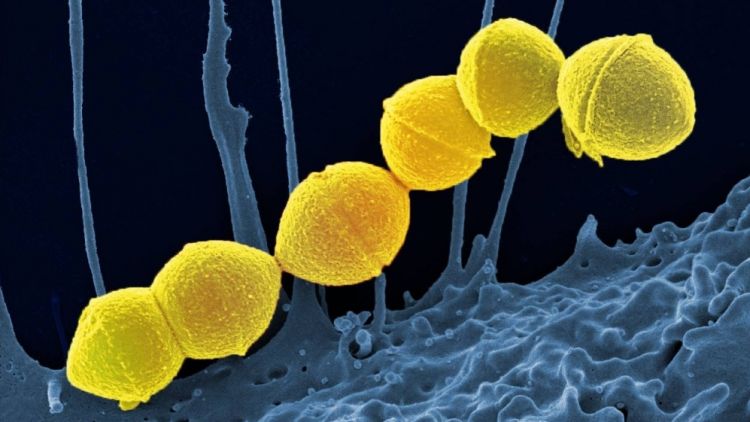 Foto digital bakteri Streptococcus Pyogenes.